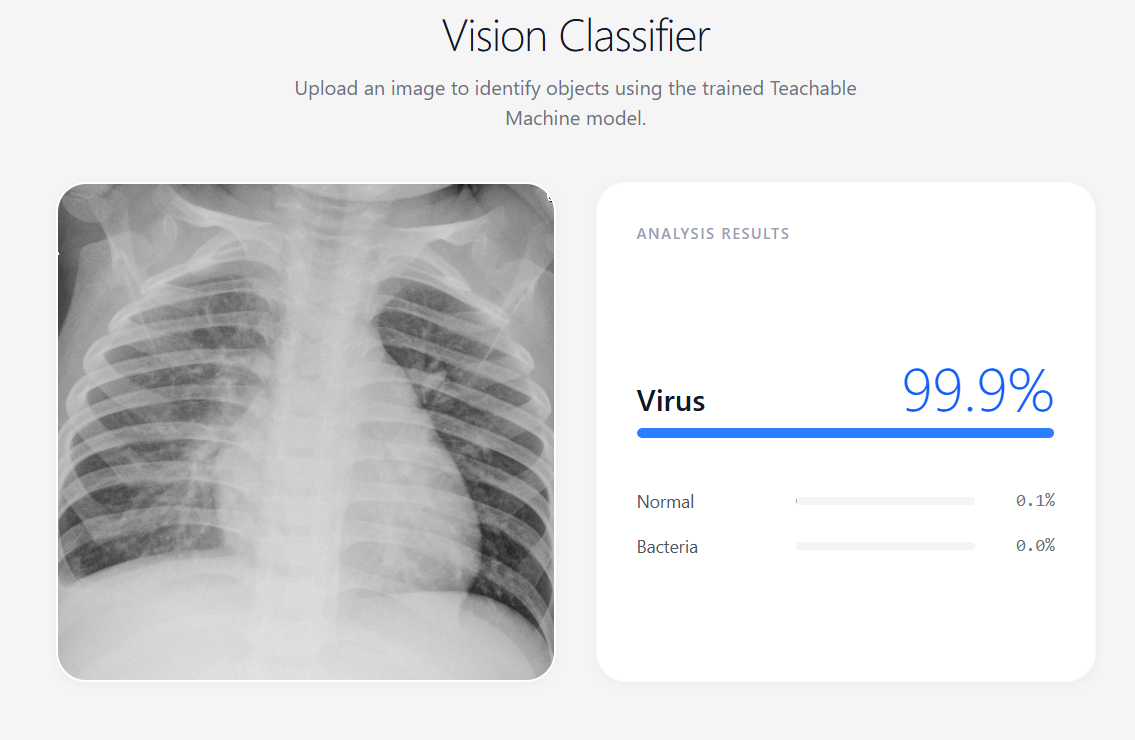 Vision Classifier interface built in Google AI Studio showing an uploaded chest X-ray on the left and analysis results on the right with Virus at 99.9 percent
